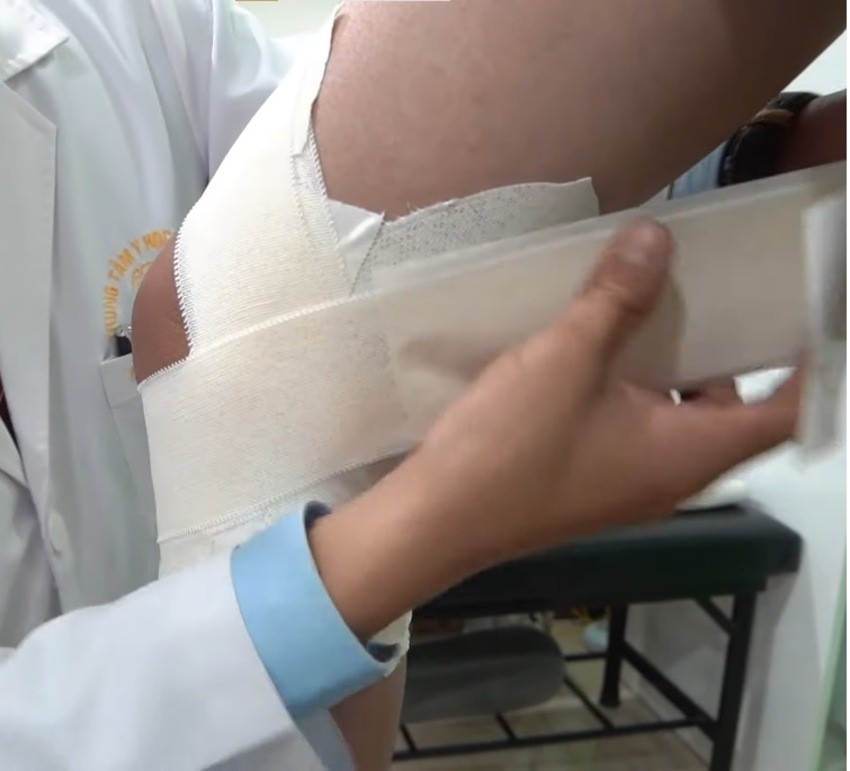 Mở rộng phần dán băng keo lên đùi - Nguồn: Internet